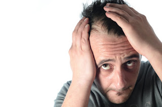 Causes of Hair Loss Causes-Symptoms-Types-Hair-Loss